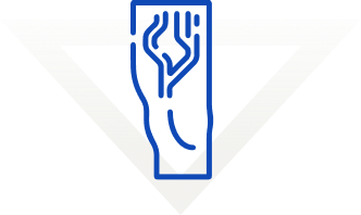 Estetická žilní chirurgie